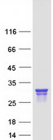 CTMP / THEM4 Protein - Purified recombinant protein THEM4 was analyzed by SDS-PAGE gel and Coomassie Blue Staining