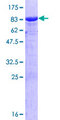 CTNNA1 / Catenin Alpha-1 Protein - 12.5% SDS-PAGE of human CTNNA1 stained with Coomassie Blue