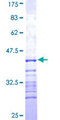 CTNNA1 / Catenin Alpha-1 Protein - 12.5% SDS-PAGE Stained with Coomassie Blue.