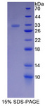 CTNNA1 / Catenin Alpha-1 Protein - Recombinant  Catenin Alpha 1 By SDS-PAGE