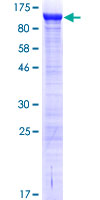 CTNNA2 / Alpha-2 Catenin Protein - 12.5% SDS-PAGE of human CTNNA2 stained with Coomassie Blue