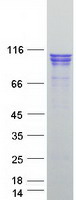 CTNNA2 / Alpha-2 Catenin Protein - Purified recombinant protein CTNNA2 was analyzed by SDS-PAGE gel and Coomassie Blue Staining