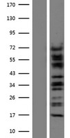 CTNNA3 / Alpha-3 Catenin Protein - Western validation with an anti-DDK antibody * L: Control HEK293 lysate R: Over-expression lysate