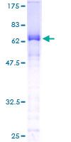 CTNNA3 / Alpha-3 Catenin Protein - 12.5% SDS-PAGE of human CTNNA3 stained with Coomassie Blue