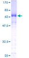 CTNNA3 / Alpha-3 Catenin Protein - 12.5% SDS-PAGE of human CTNNA3 stained with Coomassie Blue