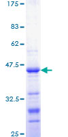 CTNNB1 / Beta Catenin Protein - 12.5% SDS-PAGE Stained with Coomassie Blue.
