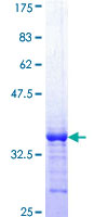 CTNNBIP1 / ICAT Protein - 12.5% SDS-PAGE Stained with Coomassie Blue.