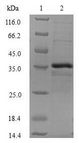 CTNNBIP1 / ICAT Protein - (Tris-Glycine gel) Discontinuous SDS-PAGE (reduced) with 5% enrichment gel and 15% separation gel.