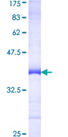 CTNNBL1 / NAP Protein - 12.5% SDS-PAGE Stained with Coomassie Blue.