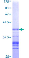 CTNND1 / p120 Catenin Protein - 12.5% SDS-PAGE Stained with Coomassie Blue.
