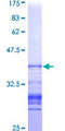 CTNND1 / p120 Catenin Protein - 12.5% SDS-PAGE Stained with Coomassie Blue.