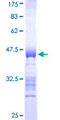 CTNND2 / Delta-2 Catenin Protein - 12.5% SDS-PAGE Stained with Coomassie Blue.
