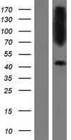 CTNS / Cystinosin Protein - Western validation with an anti-DDK antibody * L: Control HEK293 lysate R: Over-expression lysate