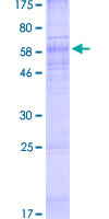 CTNS / Cystinosin Protein - 12.5% SDS-PAGE of human CTNS stained with Coomassie Blue