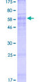 CTNS / Cystinosin Protein - 12.5% SDS-PAGE of human CTNS stained with Coomassie Blue