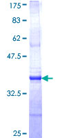 CTNS / Cystinosin Protein - 12.5% SDS-PAGE Stained with Coomassie Blue.