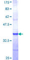 CTNS / Cystinosin Protein - 12.5% SDS-PAGE Stained with Coomassie Blue.