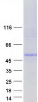 CTNS / Cystinosin Protein - Purified recombinant protein CTNS was analyzed by SDS-PAGE gel and Coomassie Blue Staining