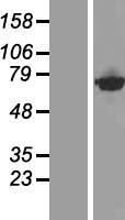 CTP Synthetase 2 / CTPS2 Protein - Western validation with an anti-DDK antibody * L: Control HEK293 lysate R: Over-expression lysate