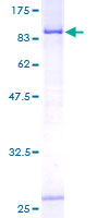 CTP Synthetase 2 / CTPS2 Protein - 12.5% SDS-PAGE of human CTPS2 stained with Coomassie Blue
