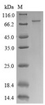 CTPS Protein - (Tris-Glycine gel) Discontinuous SDS-PAGE (reduced) with 5% enrichment gel and 15% separation gel.