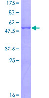 CTRB1 / Chymotrypsinogen B1 Protein - 12.5% SDS-PAGE of human CTRB1 stained with Coomassie Blue