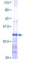 CTRB1 / Chymotrypsinogen B1 Protein - 12.5% SDS-PAGE Stained with Coomassie Blue.