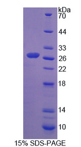 CTRB1 / Chymotrypsinogen B1 Protein - Recombinant Chymotrypsinogen B1 By SDS-PAGE