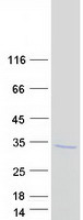 CTRB1 / Chymotrypsinogen B1 Protein - Purified recombinant protein CTRB1 was analyzed by SDS-PAGE gel and Coomassie Blue Staining
