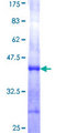 CTRL Protein - 12.5% SDS-PAGE Stained with Coomassie Blue.