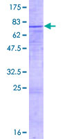 CTSA / Cathepsin A Protein - 12.5% SDS-PAGE of human PPGB stained with Coomassie Blue