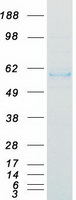 CTSA / Cathepsin A Protein - Purified recombinant protein CTSA was analyzed by SDS-PAGE gel and Coomassie Blue Staining