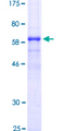 CTSB / Cathepsin B Protein - 12.5% SDS-PAGE of human CTSB stained with Coomassie Blue
