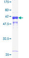 CTSB / Cathepsin B Protein - 12.5% SDS-PAGE of human CTSB stained with Coomassie Blue