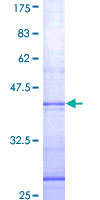 CTSB / Cathepsin B Protein - 12.5% SDS-PAGE Stained with Coomassie Blue.