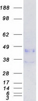 CTSB / Cathepsin B Protein - Purified recombinant protein CTSB was analyzed by SDS-PAGE gel and Coomassie Blue Staining