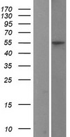 CTSC / Cathepsin C / JP Protein - Western validation with an anti-DDK antibody * L: Control HEK293 lysate R: Over-expression lysate