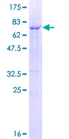 CTSC / Cathepsin C / JP Protein - 12.5% SDS-PAGE of human CTSC stained with Coomassie Blue