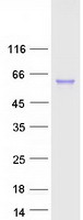 CTSC / Cathepsin C / JP Protein - Purified recombinant protein CTSC was analyzed by SDS-PAGE gel and Coomassie Blue Staining