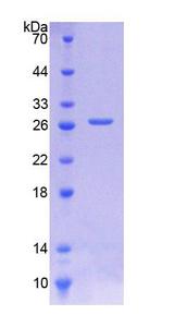 CTSD / Cathepsin D Protein - Recombinant Cathepsin D By SDS-PAGE