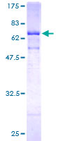 CTSE / Cathepsin E Protein - 12.5% SDS-PAGE of human CTSE stained with Coomassie Blue