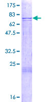 CTSF / Cathepsin F Protein - 12.5% SDS-PAGE of human CTSF stained with Coomassie Blue