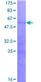 CTSG / Cathepsin G Protein - 12.5% SDS-PAGE of human CTSG stained with Coomassie Blue