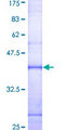 CTSG / Cathepsin G Protein - 12.5% SDS-PAGE Stained with Coomassie Blue.
