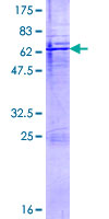 CTSH / Cathepsin H Protein - 12.5% SDS-PAGE of human CTSH stained with Coomassie Blue