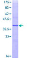 CTSH / Cathepsin H Protein - 12.5% SDS-PAGE Stained with Coomassie Blue.