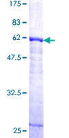 CTSK / Cathepsin K Protein - 12.5% SDS-PAGE of human CTSK stained with Coomassie Blue