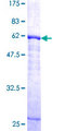 CTSK / Cathepsin K Protein - 12.5% SDS-PAGE of human CTSK stained with Coomassie Blue