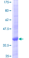 CTSK / Cathepsin K Protein - 12.5% SDS-PAGE Stained with Coomassie Blue.