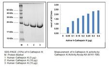 CTSK / Cathepsin K Protein